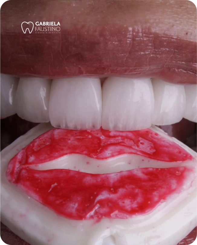 post 6 - @victtmedia